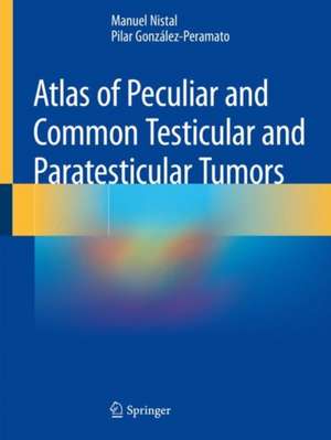 Atlas of Peculiar and Common Testicular and Paratesticular Tumors de Manuel Nistal