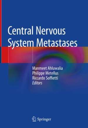 Central Nervous System Metastases de Manmeet Ahluwalia