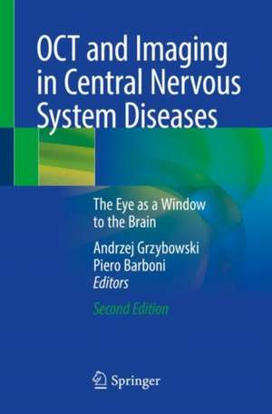 OCT and Imaging in Central Nervous System Diseases: The Eye as a Window to the Brain de Andrzej Grzybowski