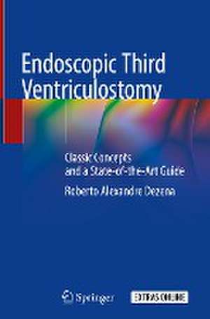 Endoscopic Third Ventriculostomy: Classic Concepts and a State-of-the-Art Guide de Roberto Alexandre Dezena