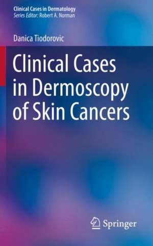 Clinical Cases in Dermoscopy of Skin Cancers de Danica Tiodorovic