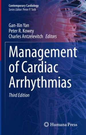 Management of Cardiac Arrhythmias de Gan-Xin Yan