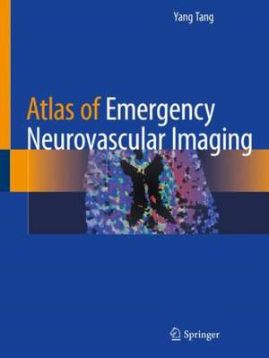 Atlas of Emergency Neurovascular Imaging de Yang Tang