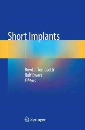 Short Implants de Boyd J. Tomasetti