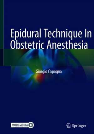 Epidural Technique In Obstetric Anesthesia de Giorgio Capogna