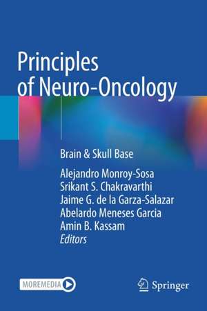 Principles of Neuro-Oncology: Brain & Skull Base de Alejandro Monroy-Sosa