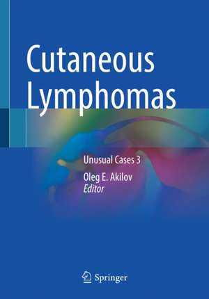 Cutaneous Lymphomas: Unusual Cases 3 de Oleg E. Akilov