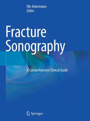 Fracture Sonography: A Comprehensive Clinical Guide de Ole Ackermann