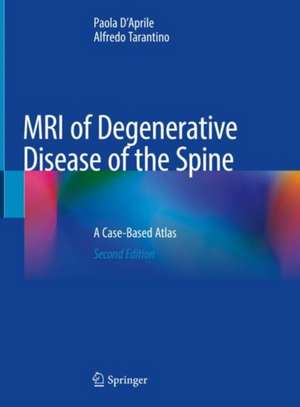 MRI of Degenerative Disease of the Spine: A Case-Based Atlas de Paola D'Aprile