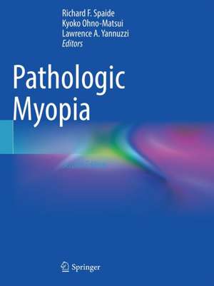 Pathologic Myopia de Richard F. Spaide