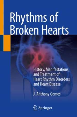 Rhythms of Broken Hearts: History, Manifestations, and Treatment of Heart Rhythm Disorders and Heart Disease de J. Anthony Gomes