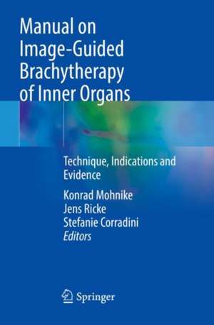 Manual on Image-Guided Brachytherapy of Inner Organs: Technique, Indications and Evidence de Konrad Mohnike