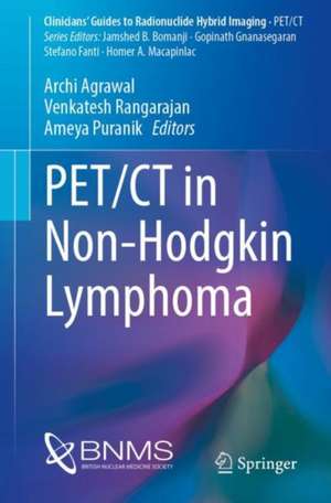 PET/CT in Non-Hodgkin Lymphoma de Archi Agrawal