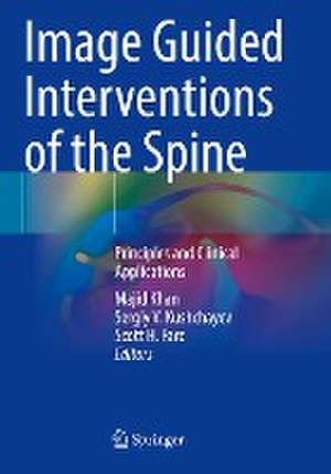 Image Guided Interventions of the Spine: Principles and Clinical Applications de Majid Khan