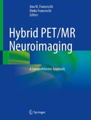 Hybrid PET/MR Neuroimaging: A Comprehensive Approach de Ana M. Franceschi