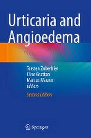 Urticaria and Angioedema de Torsten Zuberbier