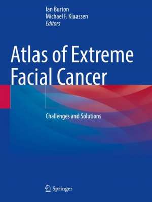 Atlas of Extreme Facial Cancer: Challenges and Solutions de Ian Burton