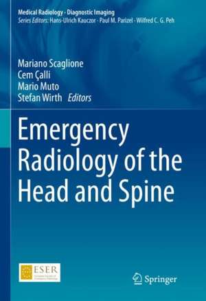 Emergency Radiology of the Head and Spine de Mariano Scaglione