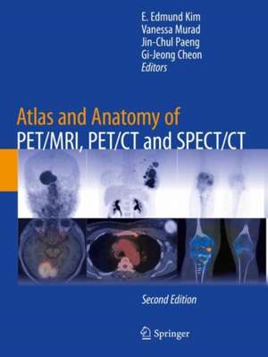 Atlas and Anatomy of PET/MRI, PET/CT and SPECT/CT de E. Edmund Kim