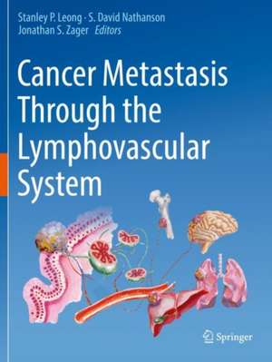 Cancer Metastasis Through the Lymphovascular System de Stanley P. Leong