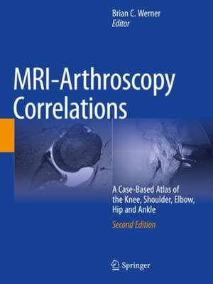 MRI-Arthroscopy Correlations: A Case-Based Atlas of the Knee, Shoulder, Elbow, Hip and Ankle de Brian C. Werner