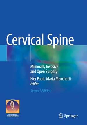 Cervical Spine: Minimally Invasive and Open Surgery de Pier Paolo Maria Menchetti