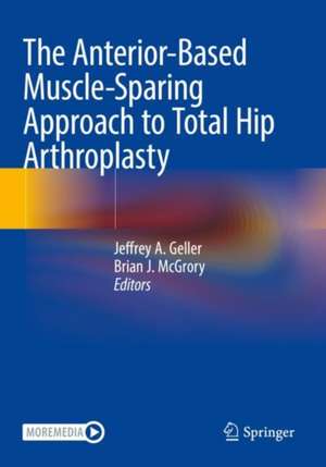 The Anterior-Based Muscle-Sparing Approach to Total Hip Arthroplasty de Jeffrey A. Geller