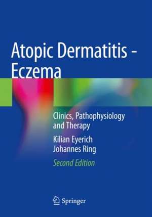 Atopic Dermatitis - Eczema de Johannes Ring