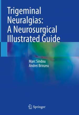 Trigeminal Neuralgias: A Neurosurgical Illustrated Guide de Marc Sindou