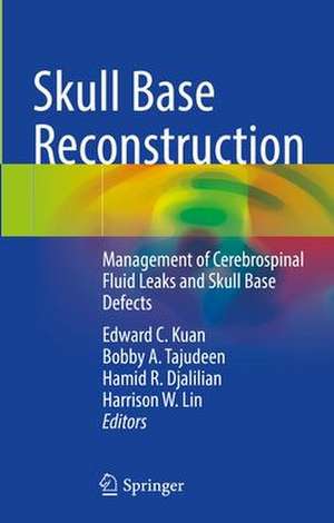 Skull Base Reconstruction: Management of Cerebrospinal Fluid Leaks and Skull Base Defects de Edward C. Kuan