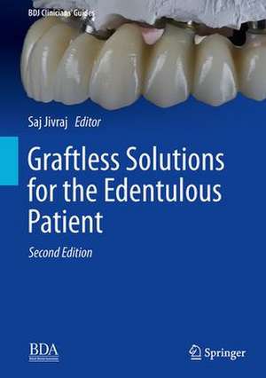 Graftless Solutions for the Edentulous Patient de Saj Jivraj