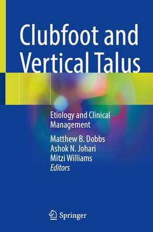 Clubfoot and Vertical Talus: Etiology and Clinical Management de Matthew B. Dobbs