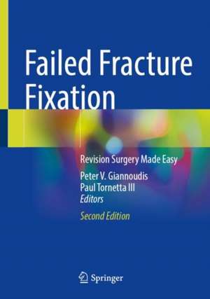 Failed Fracture Fixation: Revision Surgery Made Easy de Peter V. Giannoudis