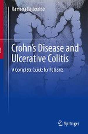 Crohn's Disease and Ulcerative Colitis: A Complete Guide for Patients de Ramona Rajapakse