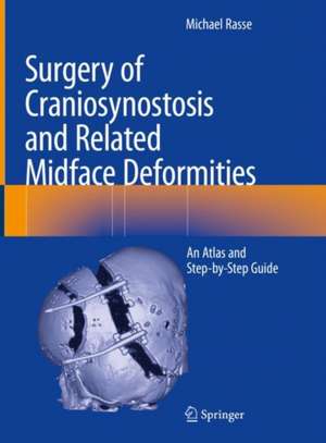 Surgery of Craniosynostosis and Related Midface Deformities: An Atlas and Step-by-Step Guide de Michael Rasse