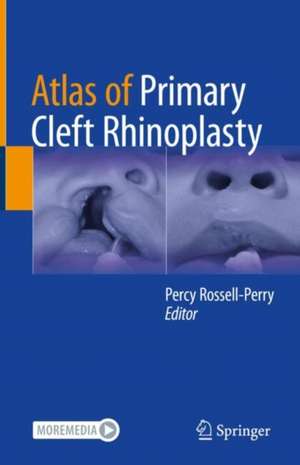 Atlas of Primary Cleft Rhinoplasty de Percy Rossell-Perry