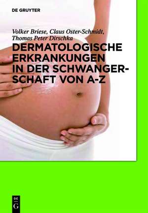 Dermatologische Erkrankungen in der Schwangerschaft von A-Z de Volker Briese