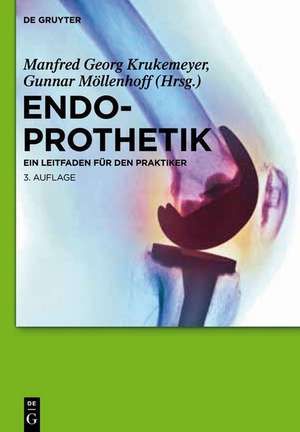 Endoprothetik: Ein Leitfaden für den Praktiker de Manfred Georg Krukemeyer