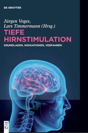 Tiefe Hirnstimulation de Voges, Jurgen