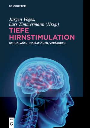 Tiefe Hirnstimulation: Grundlagen, Indikationen, Verfahren de Jürgen Voges