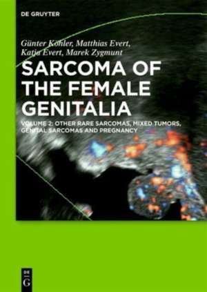 Sarcoma of the female genitalia: Other rare sarcomas, mixed tumors, genital sarcomas and pregnancy de Günter Köhler