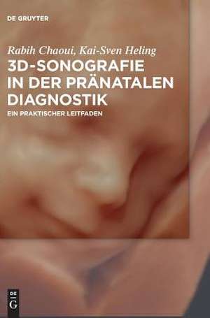 3D-Sonografie in Der Pranatalen Diagnostik: Ein Praktischer Leitfaden de Rabih Chaoui