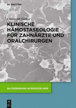 Klinische Hämostaseologie für Zahnärzte und Oralchirurgen de Christoph Sucker