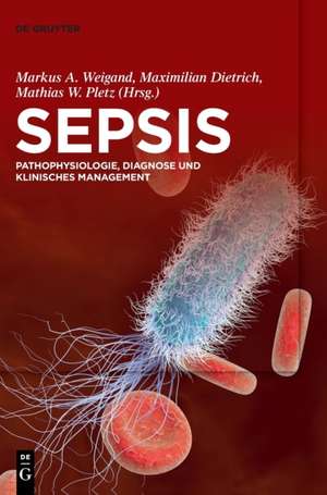 Sepsis de Markus A. Weigand