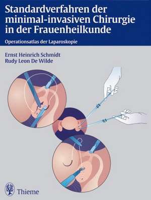 Standardverfahren der minimal-invasiven Chirurgie in der Frauenheilkunde de Ernst Heinrich Schmidt