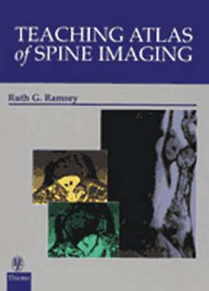 Teaching Atlas of Spine Imaging de Ramsey