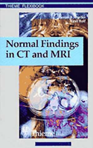 Normal Findings in CT and MRI, A1, print de Torsten Bert Möller