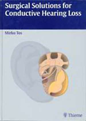 Surgical Solutions for Conductive Hearing Loss: Man Middle Ear Surgery, Volume 4 de Mirko Tos