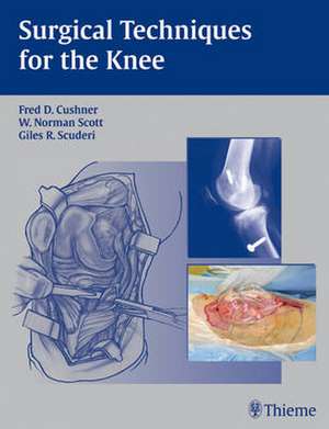 Surgical Techniques for the Knee de Cushner