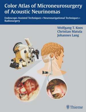 Color Atlas of Microneurosurgery of Acoustic Neurinomas de W. Koos